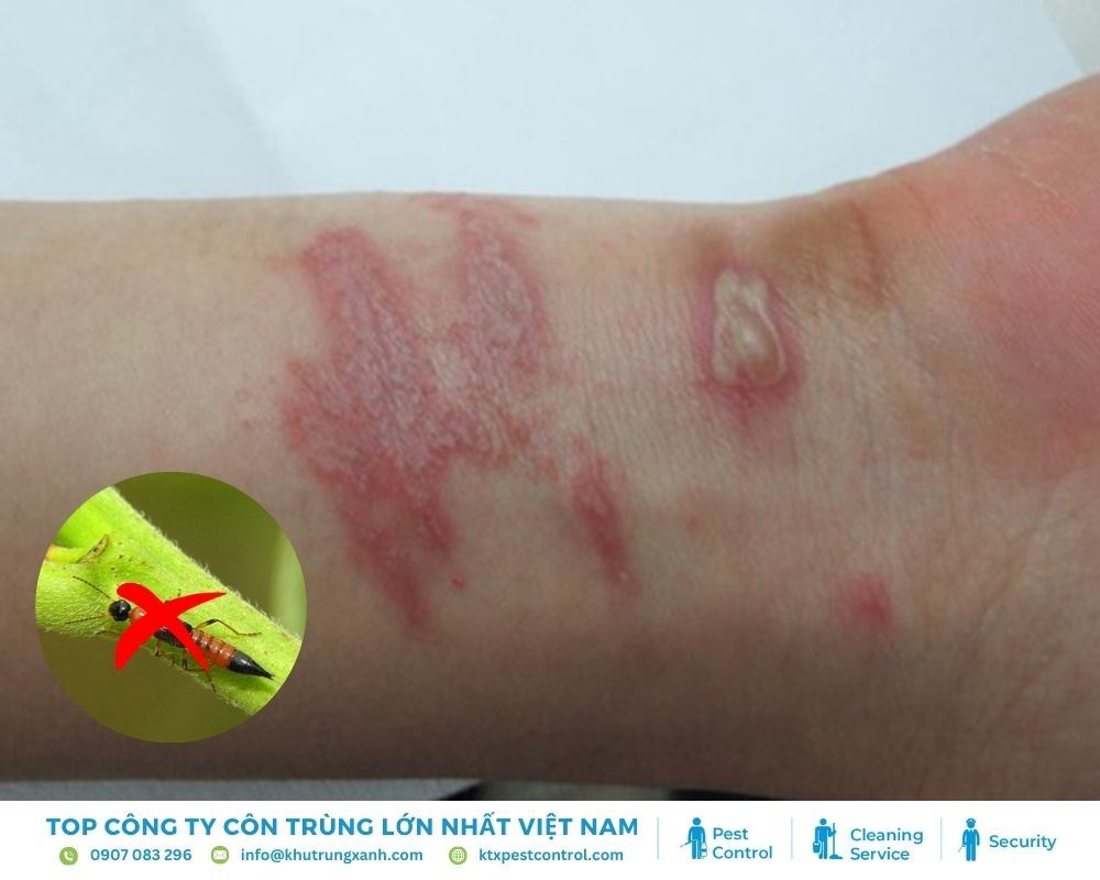 Tác hại của kiến ba khoang