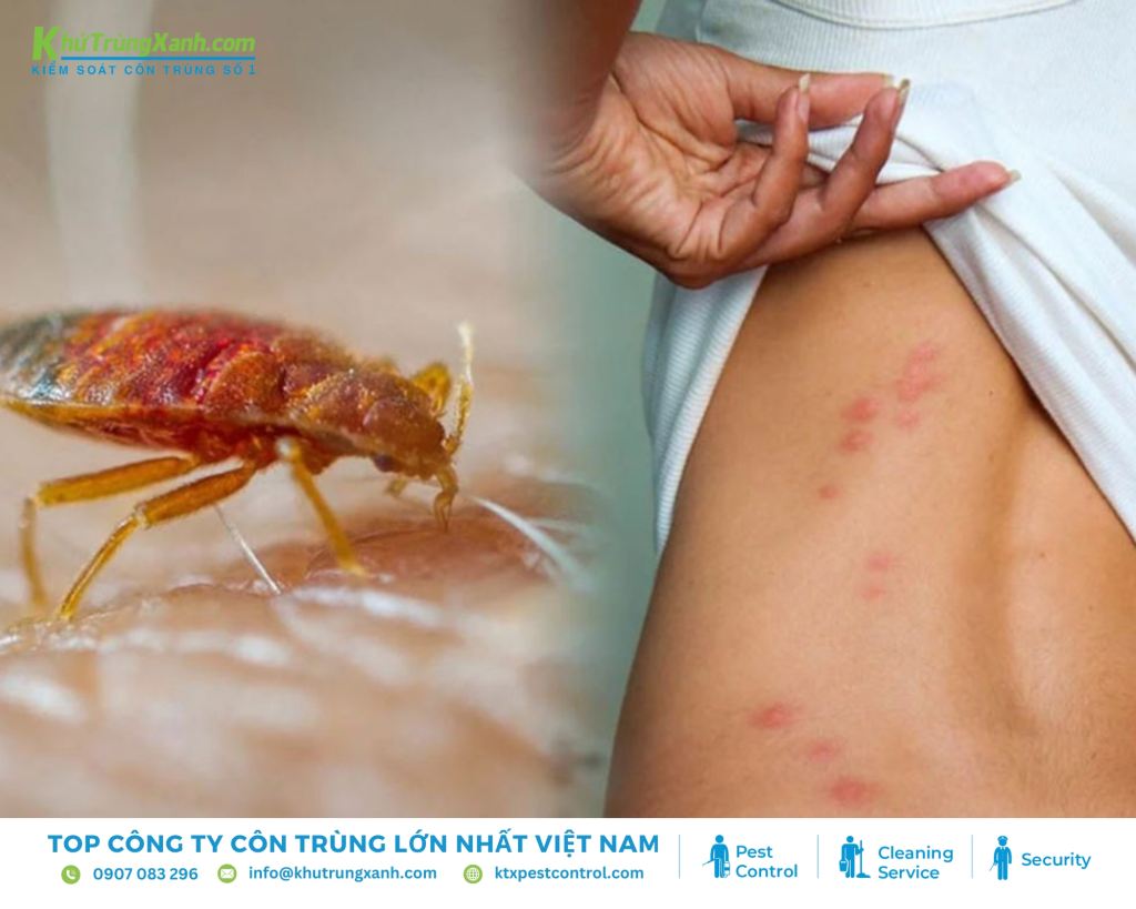 Xuất hiện những vết sưng đỏ, thường có một chấm đỏ ở giữa